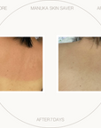 Manuka Skin Saver - Radiation & UV Damage