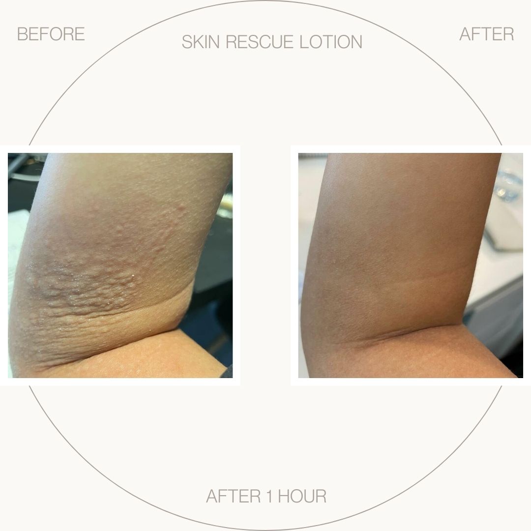 UltraSensitive Skin Rescue Lotion